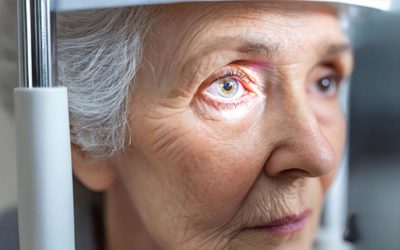 5 Facts to Know About Glaucoma