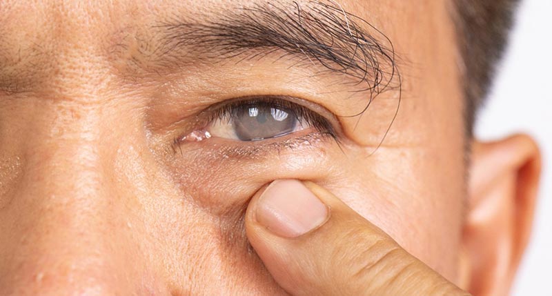 7 Cataract Myths That Could Put Your Vision at Risk